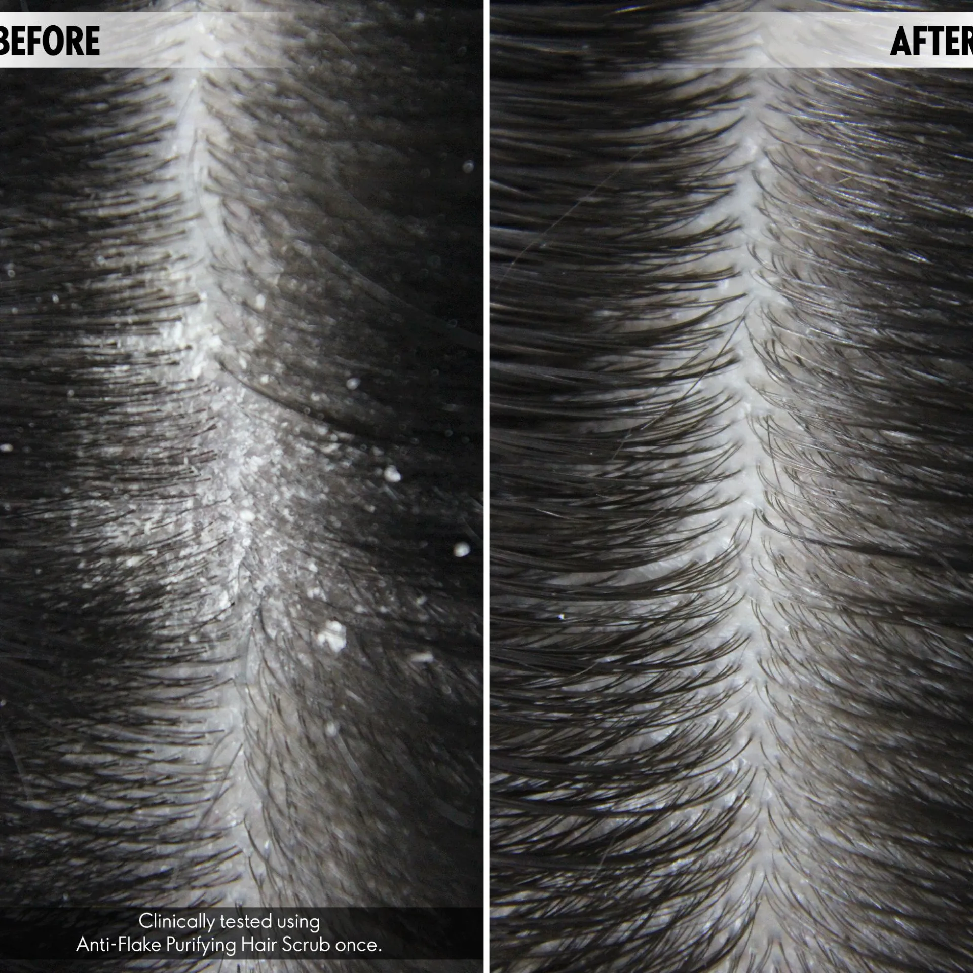 Peeling oczyszczający skórę głowy DUOLOGI 75 ml